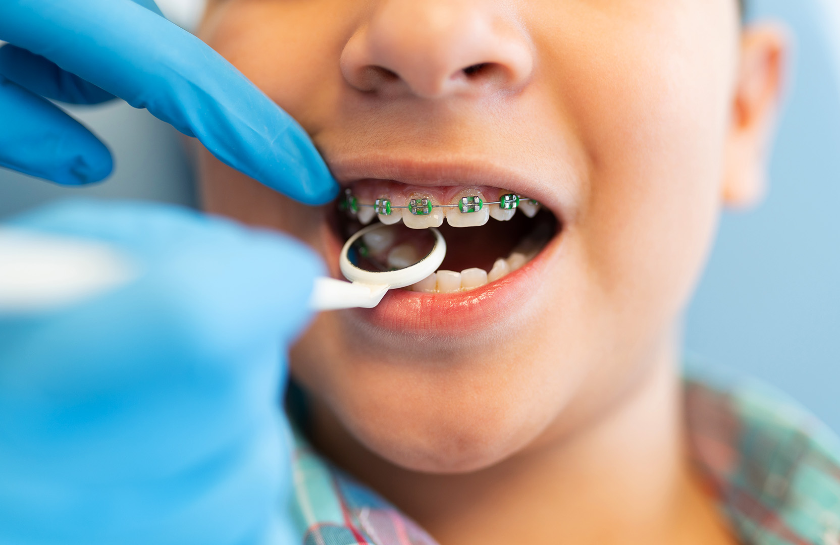 Kid with braces Image Kid with braces Image